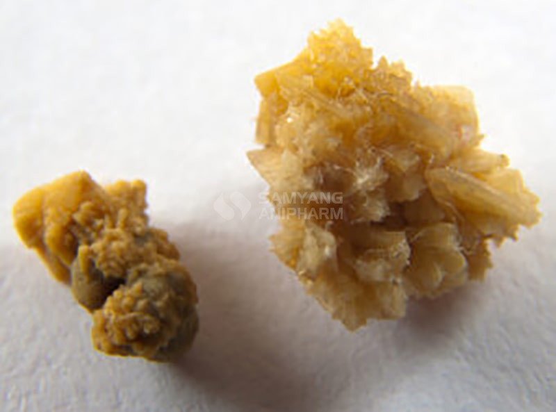 Hình dạng viên sỏi trong bàng quang của chó